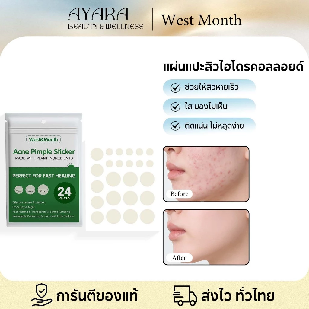 West&Month แผ่นแปะสิว ผิวหนังเทียมไฮโดรคอลลอยด์ กันน้ำและระบายอากาศได้ รูขุมขนหดตัว ลดรอยด่างดำ