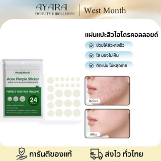West&Month แผ่นแปะสิว ผิวหนังเทียมไฮโดรคอลลอยด์ กันน้ำและระบายอากาศได้ รูขุมขนหดตัว ลดรอยด่างดำ