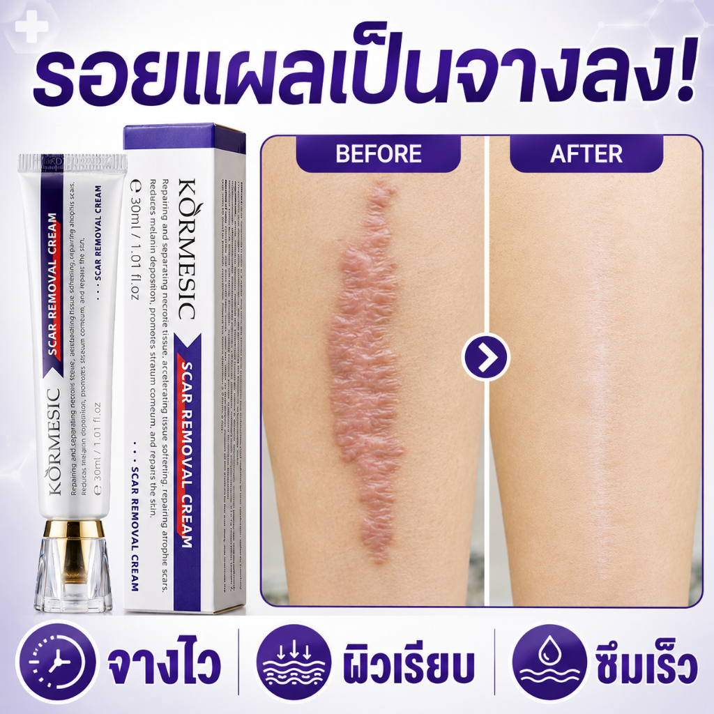 เจลซ่อมแซมรอยแผลเป็น เจลรอยแผลเป็น ครีมทาแผลเป็น ครีมแผลเป็น สําหรับรอยแผลเป็น แผลผ่าตัด น้ําร้อนลวก ครีมลบรอยแผลเป็น