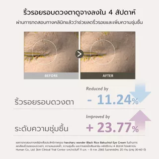 สินค้าแถมฟรีเมื่อซื้อครบ 1,190.- (Black Rice Bakuchiol Eye Cream 20 ml.) 1-31 ก.ค. 69