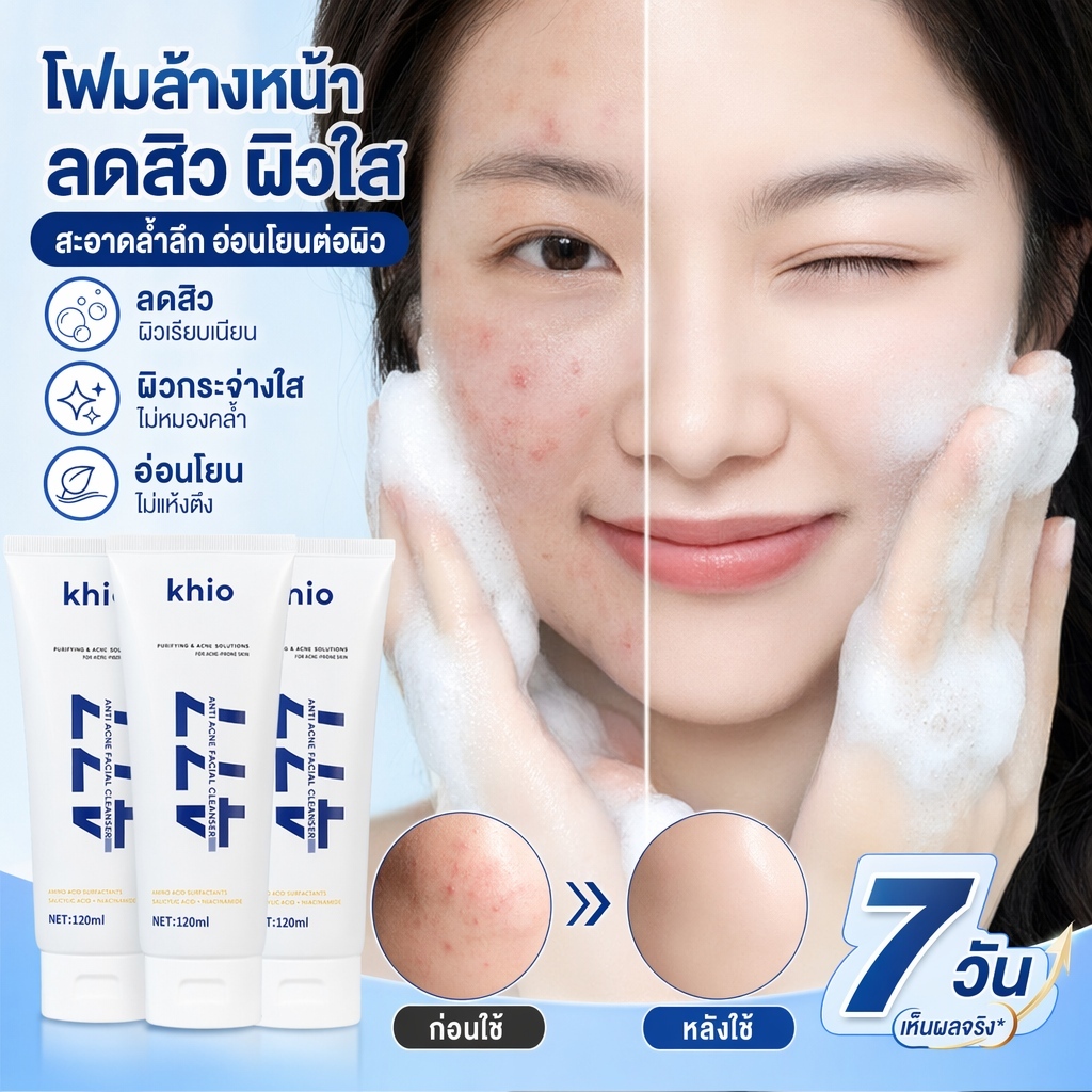 โฟมล้างหน้าใสขจัดสิวหัวดำ ทำความสะอาดลึกรูขุมขน