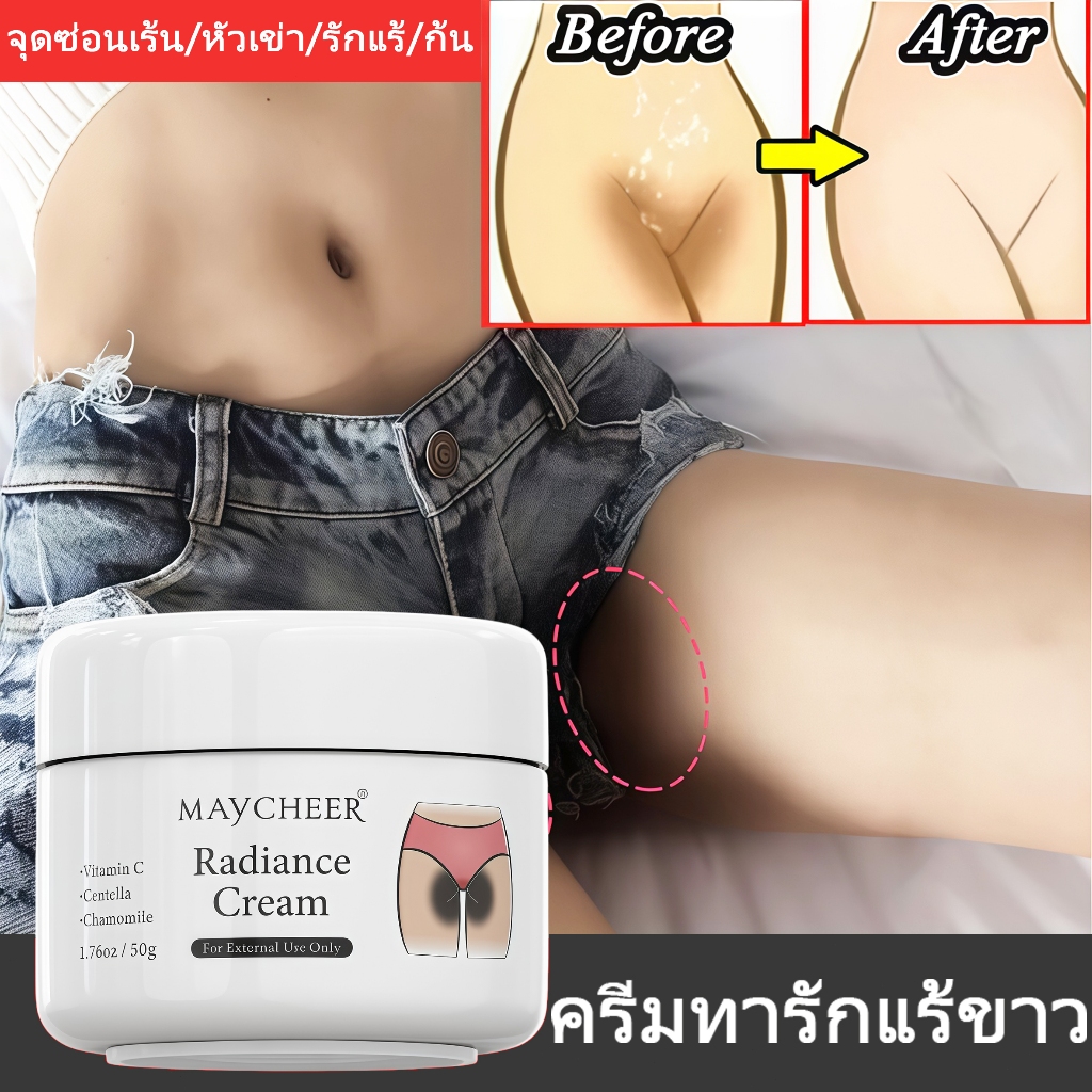 ครีมทารักแร้ขาว ระงับกลิ่น ครีมขาหนีบดำ ครีมก้นขาว เหมาะสำหรับ จุดซ่อนเร้น หัวเข่า รักแร้ ก้น