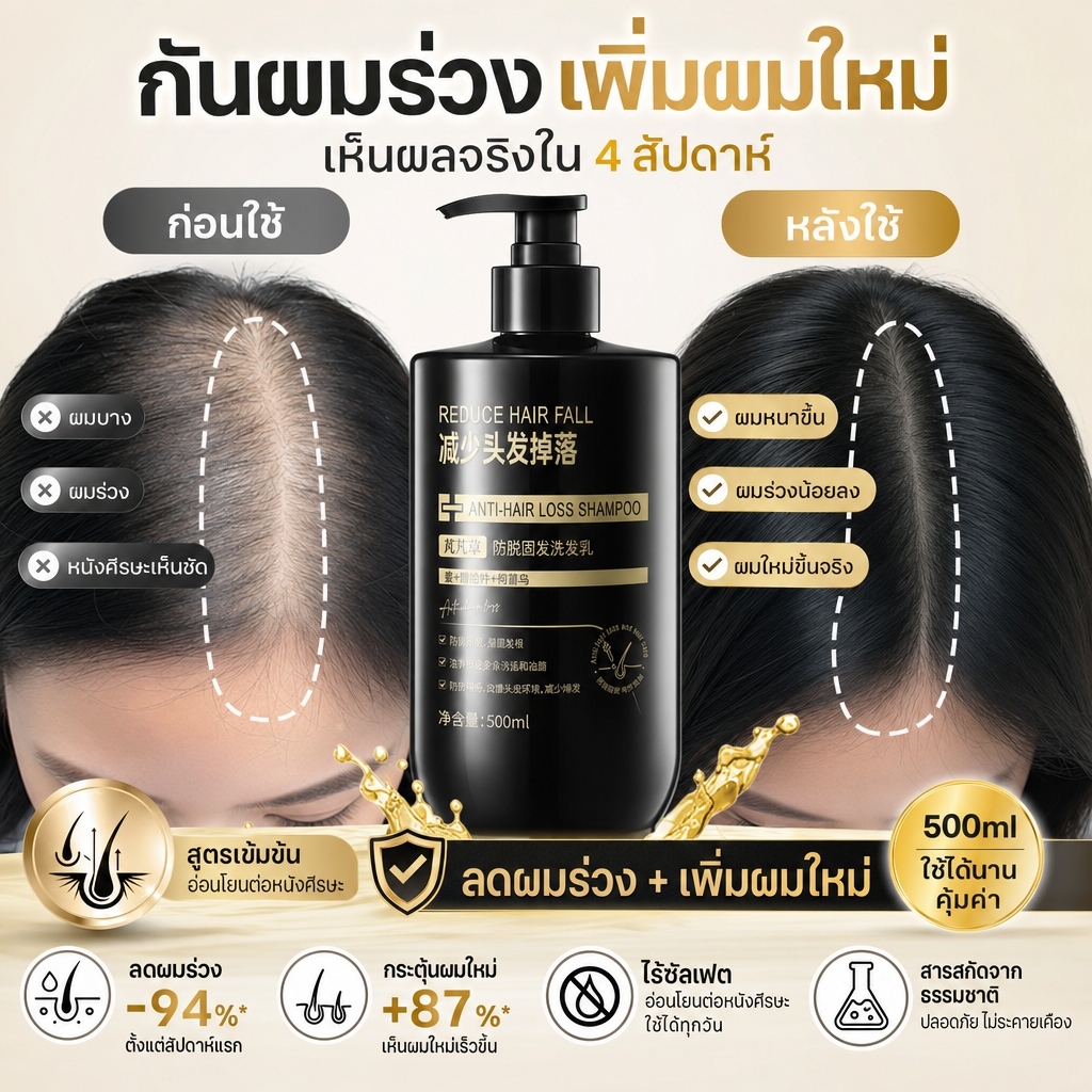 ยาสระผมขิงเร่งผมยาว ปกป้องรากผมลดการหลุดร่วง ปรับปรุงสภาพเส้นผม