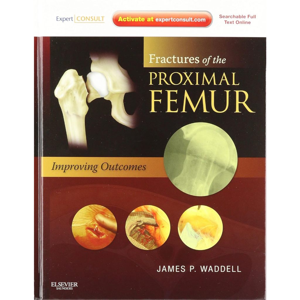 หนังสือ Fractures of the Proximal Femur: Improving Outcomes ed 1/2011