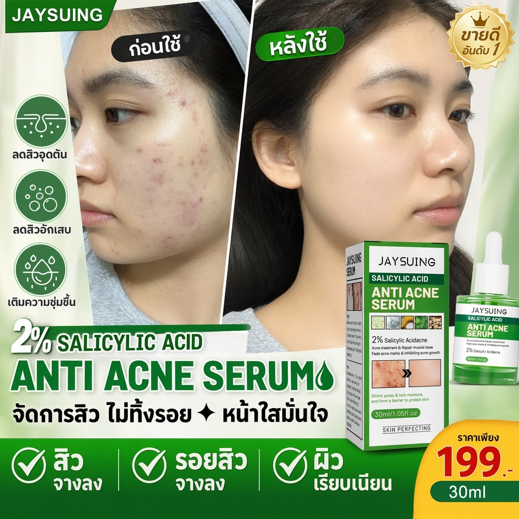 เจลแต้มสิว 30ml เซรั่มและครีมลดสิว กำจัดสิว ลบรอยสิวให้ผิวเรียบเนียน