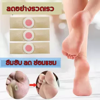 🟢ส่งในไทย แผ่นรองเท้า สำหรับหนังเท้าด้าน แผ่นแปะตาปลา สูตรพืช ใช้ง่าย [ ของแท้] เอลิเวอร์ 24แผ่น/กล่อง