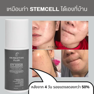 EGF serum ใส่ EGF 1000 PPM *เพิ่มPEPTIDE+ECTOIN+SOD+PENTAVITIN