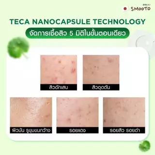 SMOOTO Official สมูทโตะ แอคเน่ แบริเออร์ ซูทติ้ง เซรั่ม (SMT200 / กล่อง)