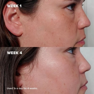 Paula's Choice Skin Perfecting 2% BHA Liquid Exfoliant 30ml/118ml
