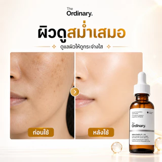 The Ordinary Alpha Arbutin 2% + HA เซรั่มลดจุดด่างดำ ลดฝ้ากระ รอยสิว ผิวใสขาวกระจ่าง อ่อนโยน 30ml