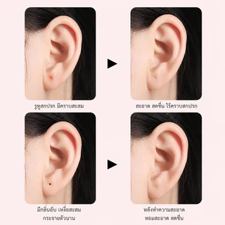 ไหมแคะหู ทำความสะอาดรูหู อุปกรณ์ทำความสะอาดหู ขจัดขี้หู กลิ่นอับ ใช้ง่าย อ่อนโยน ไม่ระคายเคือง Dream Jewelry