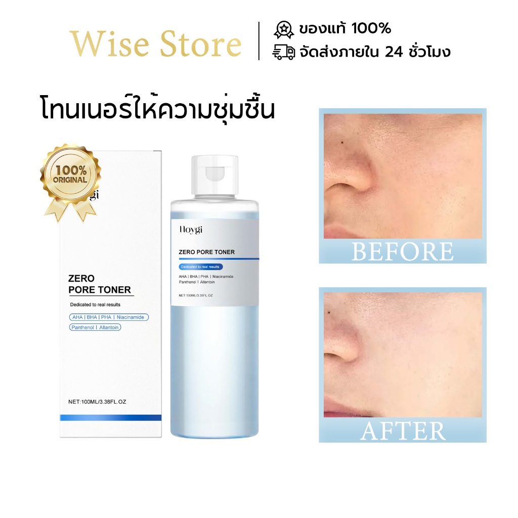 Hoygi โทนเนอร์ โทนเนอร์ผิวกาย ผลัดเซลล์ผิว ลดสิวอุดตัน กระชับรูขุมขน บำรุงความชุ่มชื้นยาวนาน ลดความหมองคล้ำ ผิวใส 100ml