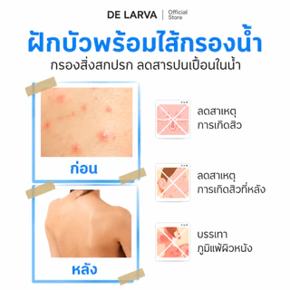 DE LARVA ฝักบัวกรองน้ำ 5 โหมด หัวฝักบัวแรงดันสูง Shower Filter กรองละเอียด ลดตะกรัน ลดกลิ่นคลอรีน ฟรีไส้กรอง 5 ชิ้น