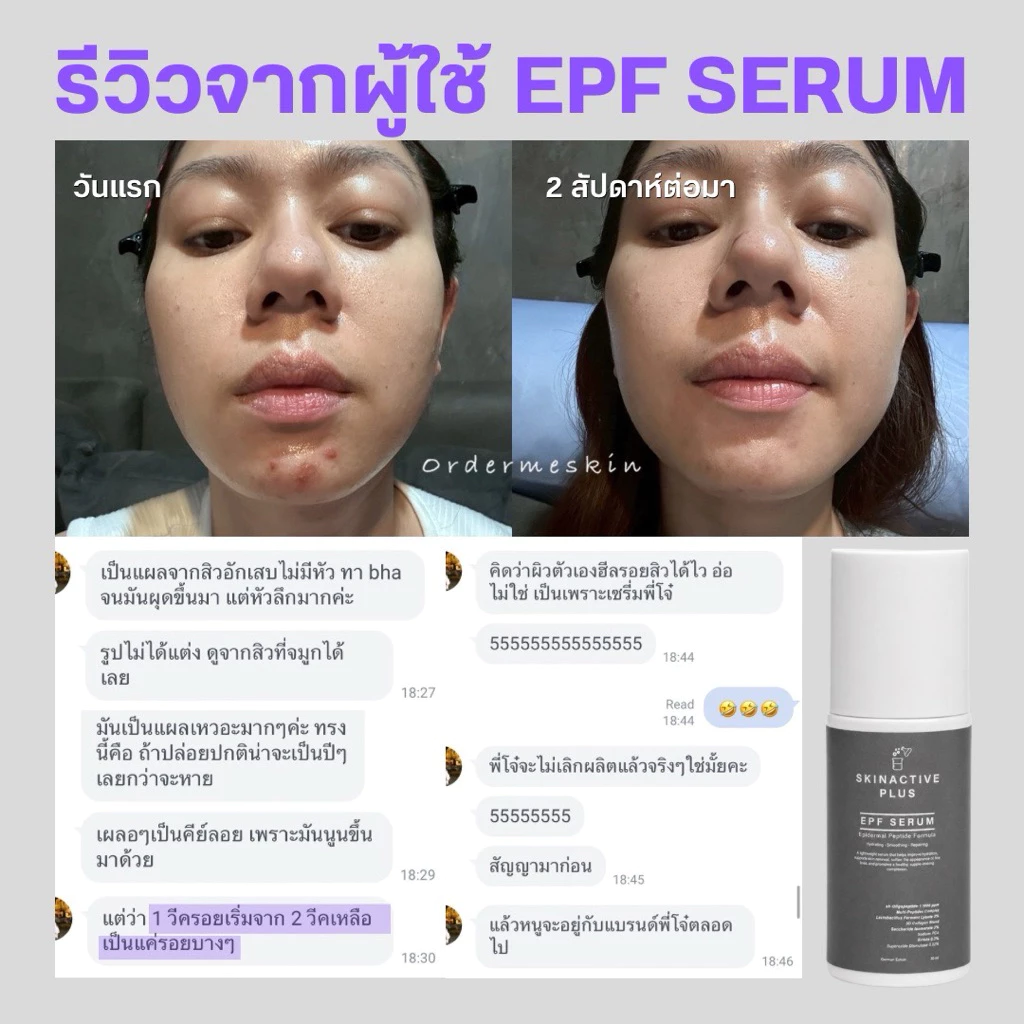 EGF serum ใส่ EGF 1000 PPM *เพิ่มPEPTIDE+ECTOIN+SOD+PENTAVITIN
