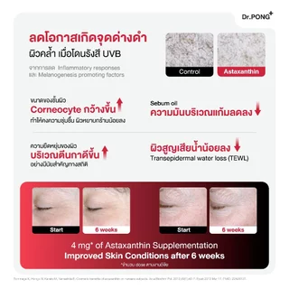 ใหม่! Dr.PONG ASTAXANTHIN MINI 6 MG PLUS VITAMIN E สูตรใหม่ แอสตาแซนธิน มินิ 6 มก. พลัส วิตามิน อี ลดริ้วรอย ผิวเด้ง