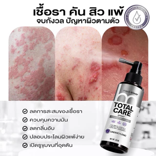 (เมดิเคลียร์) Medi-Klear สเปรย์สิวหลัง ขนคุด ผื่นคัน ผิวเชื้อรา Total Care Spray