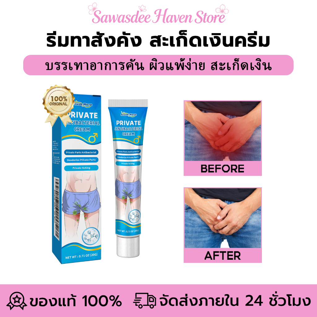 South Moon ครีมทาสังคัง สะเก็ดเงินครีม ครีมบำรุงผิว 20g ทาแก้อาการคันในร่มผ้า ทากากเกลื้อน รักษาสังคัง สมุนไพรธรรมชาติ