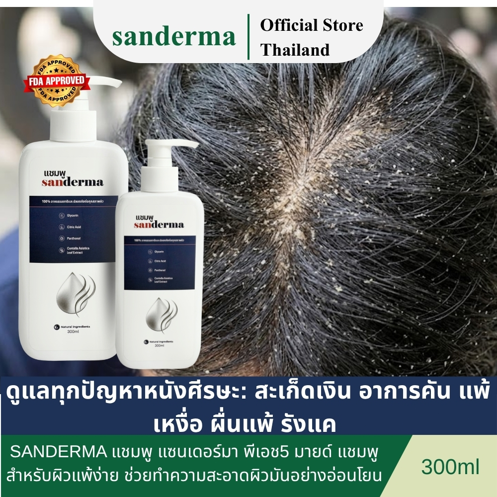 [ซื้อยาสระผม 1 แถมสบู่ 1] SANDERMA แชมพู แซนเดอร์มา แชมพู สำหรับผิวแพ้ง่าย ช่วยทำความสะอาดผิวมันอย่า