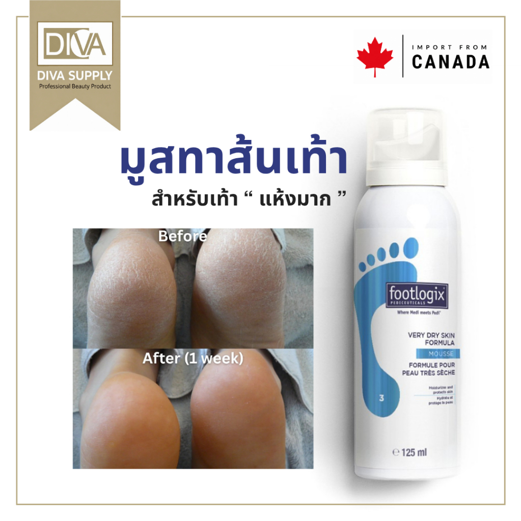 Footlogix #3 มูสบำรุงส้นเท้า ครีมทาส้นเท้า สำหรับเท้าแห้งมาก ซึมไว ไม่เหนียว 125ml