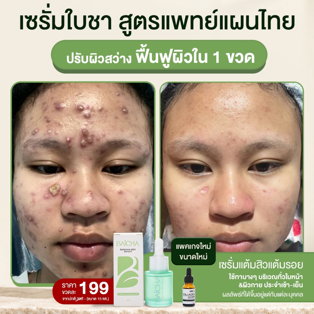 เซรั่มใบชา 15 ml สูตรแพทย์แผนไทย แพคเกจใหม่