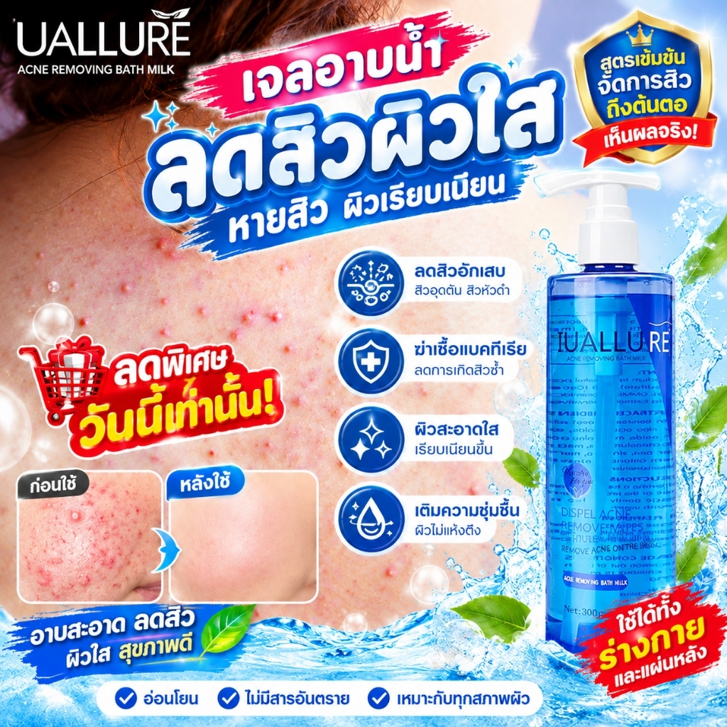 เจลอาบน้ํา ครีมอาบน้ำลดสิว เจลอาบน้ำไวท์เทนนิ่งผิว 300ml อ่อนโยนไม่ระคายเคือง กำจัดไร ล้างให้มีผิวสวยใสไร้สิวออ