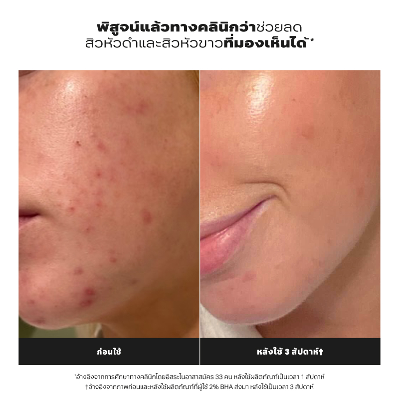Paula's Choice مقشر سائل 2% BHA ‏118 مل (عبوتان) — صورة 5