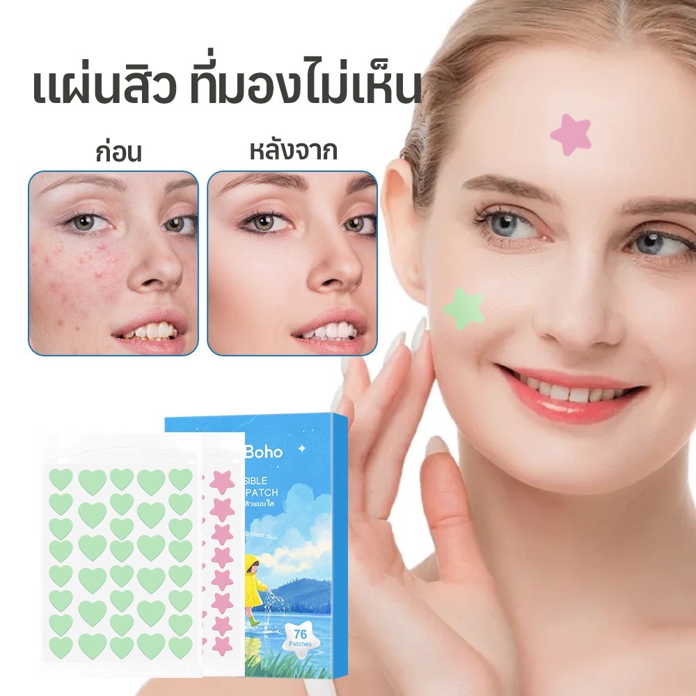 แผ่นแปะสิว Che Boho สูตรจากพืช เหมาะกับสิวทุกประเภท บอกลาผิวเป็นสิวง่ายที่น่าอายได้เลย