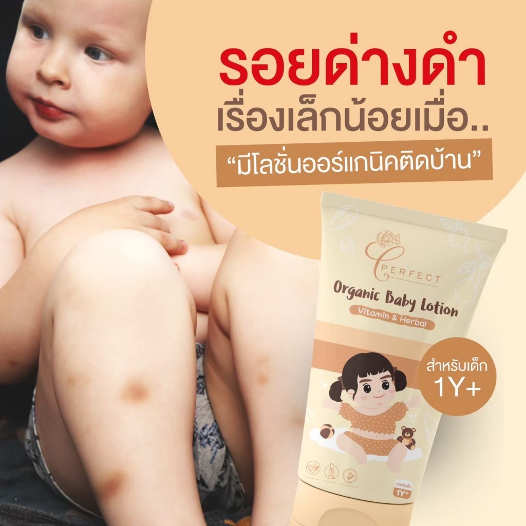 Perfect โลชั่นออร์แกนิค แก้ปัญหาขาลาย บำรุงผิวขาว กระจ่างใส ลดรอยยุงกัด กู้ผิวคล้ำเสีย เหมาะสำหรับเด็กอายุ 1 ขวบขึ้นไป รูปที่ 7