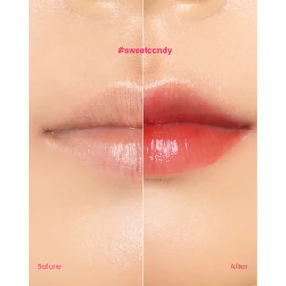 [ลดหั่นครึ่ง 1 ชิ้น สี SWEET CANDY ] OABS Kiss of Care ลิปเซรั่ม Peptide Lip Treatment Serum 10ml