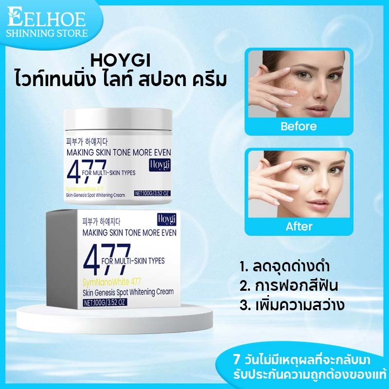 Hoygi 477ครีมแก้ฝ้า ครีมทาหน้า กระและฝ้าจางลงยับยั้งการสร้างเมลามินเติมเต็มความชุ่มชื้นแก่ผิว 100g