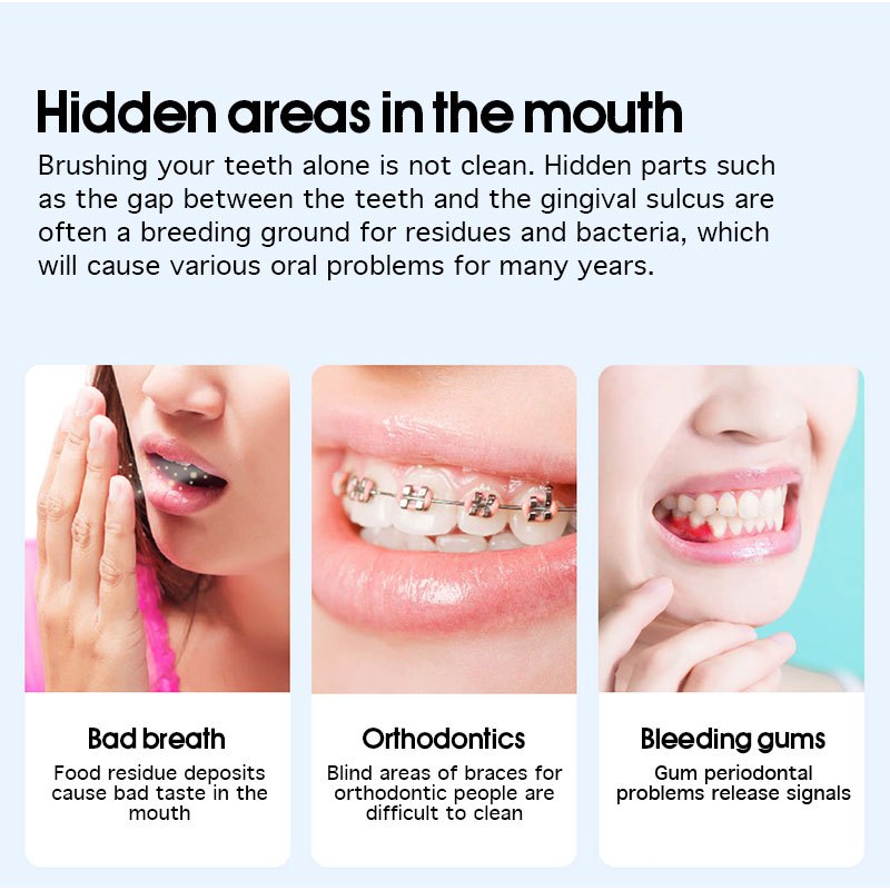 ENPULY M6 Plus Oral Irrigator Water Flosser เครื่องกำจัดสิ่งสกปรกในช่องปาก 140 Psi กันน้ำ IPX8 140ML - รูปที่ 4