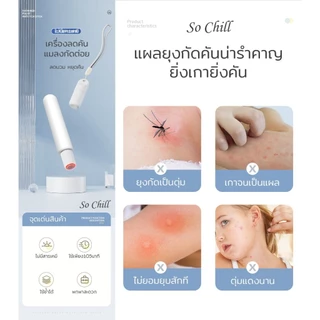 So Chill เครื่องลดคัน ลดบวมจากแผลยุงกัด ไม่มีสารเคมี ปลอดภัย คนมีครรภ์ เด็กเล็กสามารถใช้ได้ พกพาสะดวก ใช้ง่าย