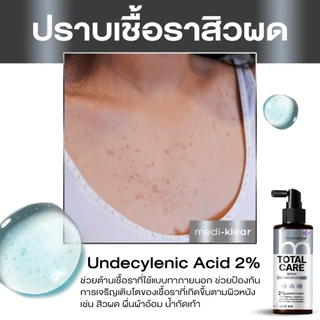 [ร้านยา] medi klear สเปรย์แก้คัน สิวที่หลัง สิวที่หลังและหน้าอก สิวที่ก้น ผดผื่น กากเกลื้อนเชื่อรา แก้คัน ลดสิว