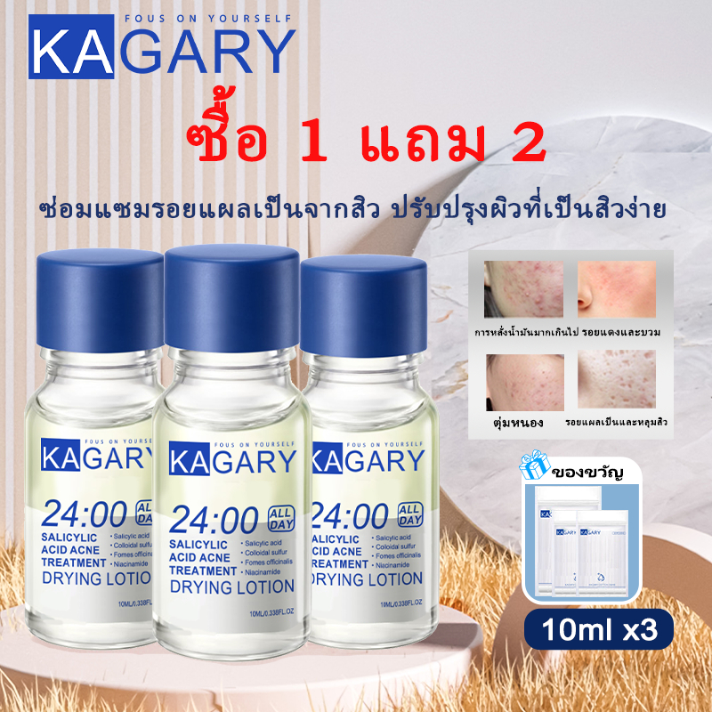 [ซื้อ 1 แถม 2] 24H Acne Serum แต้มสิว Acne Clear Potion เจลแต้มสิว รอยดำ เซรั่มลดสิวอักเสบ เห็นผลไว