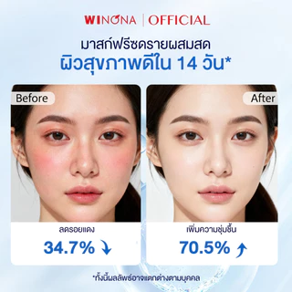 Winona มาส์กหน้า Mask Sheet รอยแดง ลดการระคายเคือง ซ่อมแซมผิวเสีย วิโนน่า ชีทมาส์กกู้ผิวเร่งด่วน บูสผิวอิ่