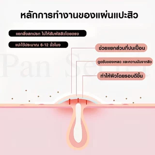 JAYSUING แผ่นแปะสิว ( 1 แถม 1 ) น่ารัก หมีเนย สีสันสดใส กันน้ำ Acne Patches Skincare H102