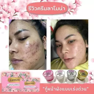 ลาโมน่าครีม Lamona Cream ของแท้ 100% รับตรงจากแบรนด์ เซ็ตครีมบำรุงผิว ริ้วรอยเหี่ยวย่น ฝ้า กระ จุดด่างดำ