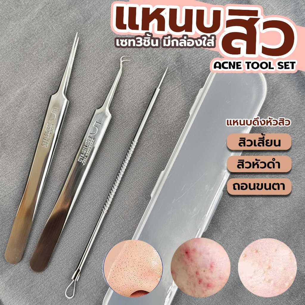 แหนบสิว 3 ชิ้นพร้อมกล่อง งานสแตนเลสแท้ หนีบแน่น ปลายแหลม ดึงสิวเสี้ยนสิวหัวดำได้ตรงจุด