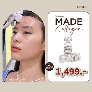 โปรแกรม MADE Collagen 4 cc 16 จุดทั่วใบหน้า