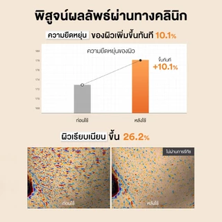 COSRX The Alpha-Arbutin Discoloration Care Hydrogel Mask ดิ อัลฟ่า-อาร์บูติน ดิสโคโลเรชั่น แคร์ ไฮโดรเจล มาส์ก