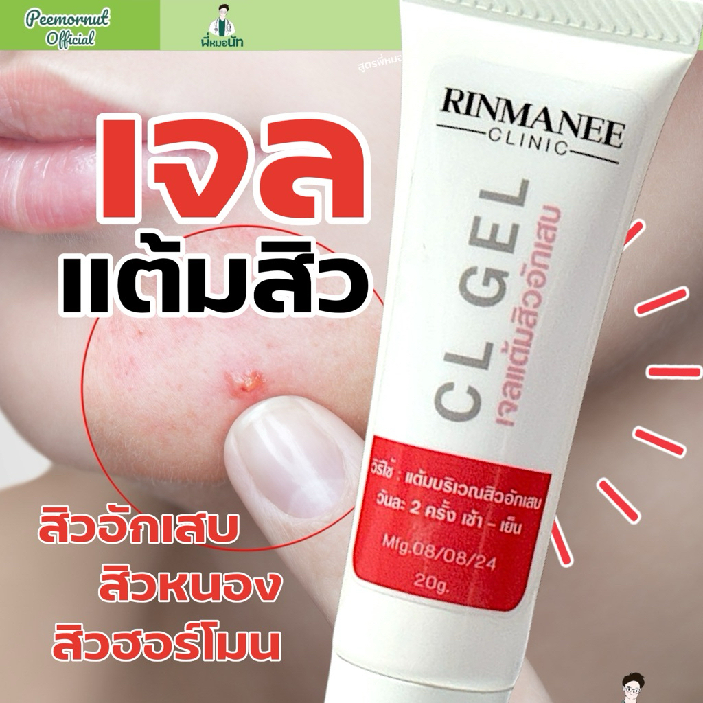 CL แต้มสิวอักเสบ สิวอักเสบ สิวไต เจลแต้มสิว สิวฮอร์โมน ครีมแต้มสิว สิวอักเสบยุบ สิวหนอง   สูตรคลินิก