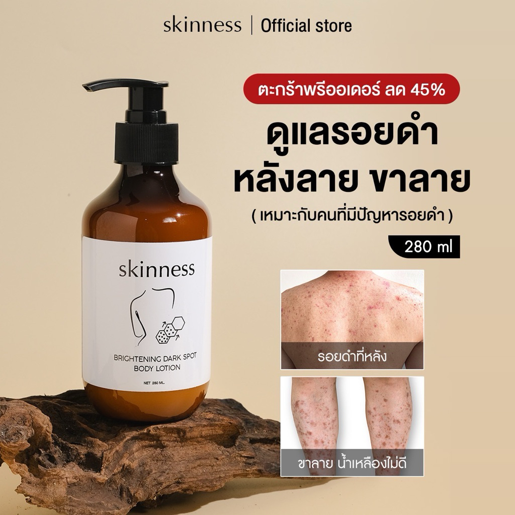 พิเศษ45% [เฉพาะพรีออเดอร์] skinness brightening dark spot body lotion plus