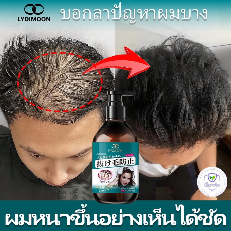 แชมพูลดผมร่วง ลดผมร่วง ลดรังแค บำรุงรากผม ส่งเสริมการเจริญเติบโตของเส้นผมใหม่ ขนาด 300 มล.