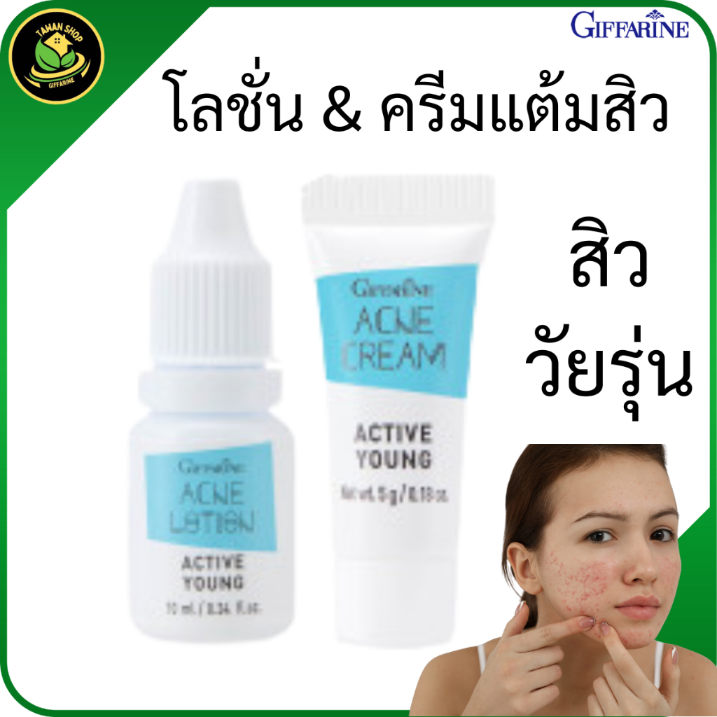 กิฟฟารีน แอคทีฟ ยัง โลชั่นแต้มสิว & ครีมแต้มสิว ลดสิววัยรุ่น สิวอุดตัน สิวอักเสบ ยุบไว หน้าใส