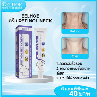 EELHOE ครีมเรตินอลลดรอยคอ ครีมทาคอ ลดริ้วรอย ฟื้นฟูผิวหย่อนค…