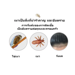 Scully สคัลลี่ แชมพูฆ่าเหา กำจัดเหา ฆ่าเหา แชมพูขจัดเหา ปลอดภัย อ่อนโยน anti-lice shampoo
