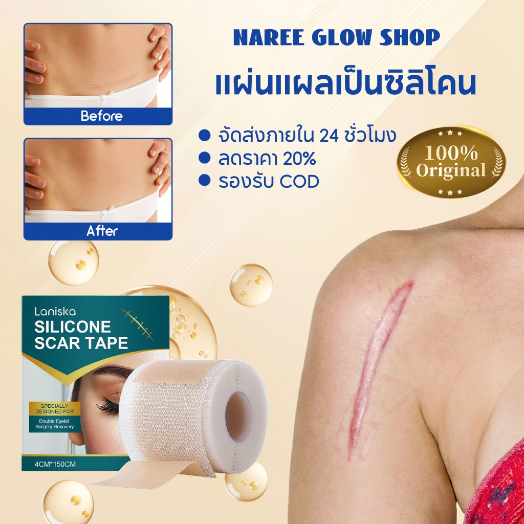 Laniska แผ่นแผลเป็นซิลิโคน Silicone Scar Tape 4cm*150cm เทปซิลิโคนสำหรับรอยแผลเป็น, แผ่นซิลิโคนสำหรับรอยแผลเป็น