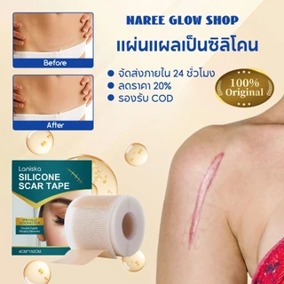 Laniska แผ่นแผลเป็นซิลิโคน Silicone Scar Tape 4cm*150cm เทปซิลิโคนสำหรับรอยแผลเป็น, แผ่นซิลิโคนสำหรับรอยแผลเป็น