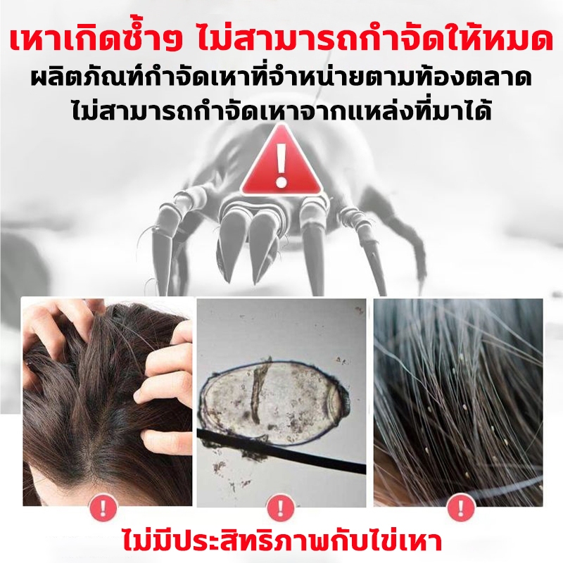 กำจัดเหาและไข่เหา2in1 ยาฆ่าเหา ลดคันลดรังแค อ่อนโยนไม่ทำร้ายผิว แชมพูกำจัดเหา กำจัดเหาและไข่ แก้คัน กลิ่นหอม แชมพูฆ่าเหา - รูปที่ 4