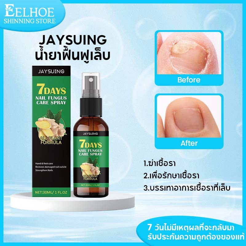 Jaysuing น้ำยาฟื้นฟูเล็บ ฆ่าเชื้อราเพื่อรักษาเชื้อราผลิตภัณฑ์ดูแลเล็บเสริมความแข็งแรงปกป้องเล็บเปราะ